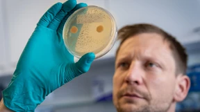 Auf der Suche nach neuen Heilmitteln in alten Pilzkulturen