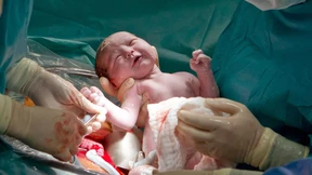 Wie der Kaiserschnitt zum Klassiker wurde