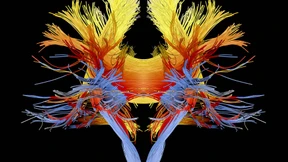 Wie genial ist unser Gedächtnis?