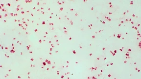 Ein neues Antibiotikum gegen Tripper