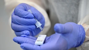 Weiterer Rückgang bei mehreren Corona-Indikatoren