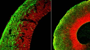 Was macht man mit so wenig Hirn?