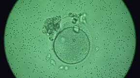 Von folgsamen gesunden Zellen und von Krebszellen im Amokmodus