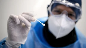 Variantenbestimmung in anderthalb Stunden