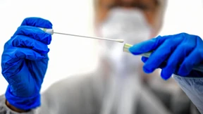 RKI: Zahl der aktiven Corona-Fälle steigt erstmals seit zwei Monaten