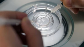 Rückschrittliches Reproduktionsrecht