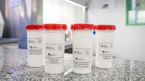 Keine Hinweise auf gefährliche Hantavirus-Mutation