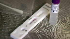 Rund ein Drittel der Betriebe bietet schon Corona-Tests an