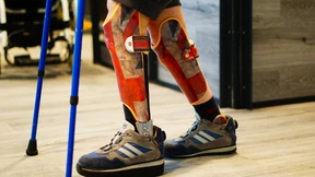 Prothesen für den selbstbewussten Auftritt