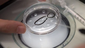 Merck sponsert Beschäftigten Kinderwunschbehandlung