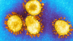 Corona – oder das erste halbe Jahr