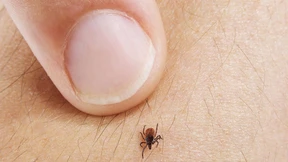 Gibt es so viele Zecken wie noch nie?