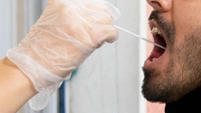 Die Sieben-Tage-Inzidenz steigt deutlich