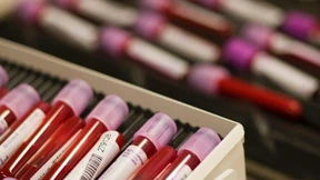 Gesamtdeutsches Dopen