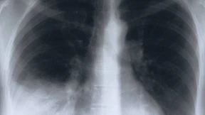 Bloß nicht unterschätzen!