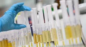 „Doping kann in jeder Sportart etwas bringen“