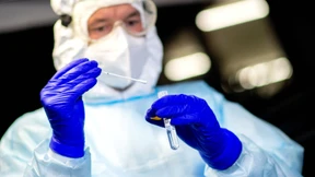 Der Anstieg der Infektionszahlen scheint etwas abzuflachen