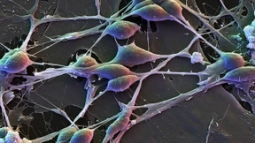 Wie frühkindlicher Stress das Gehirn schädigen kann