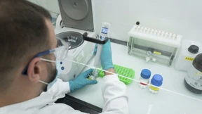 Das Buhlen um Evotec beginnt