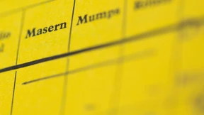 Masern, Blaues Auge, Psychosen