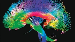 „Unbewusste Siegeshemmungen“