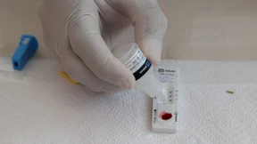 „HIV ist ein wirklich harter Gegner“