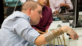 Gelähmter steuert Arm erstmals mit seinen Gedanken