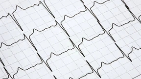 Sanfte Stromstöße fürs rasende Herz