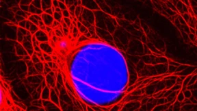 Die Millionenfrage an Angela Merkel