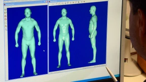 Fördert die Sterilisation das Krebsrisiko?