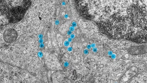 Erreger wieder auferstanden