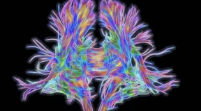 „Wir sind den USA und China einen Schritt voraus“