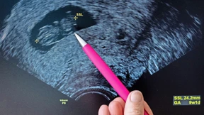 Abtreibung darf keine Kassenleistung werden