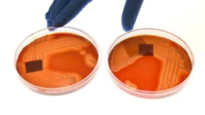 Eine Lebensretter-Maschine auf Station