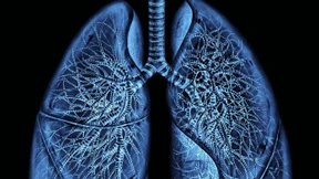 Wenn die Maschine das Atmen übernimmt