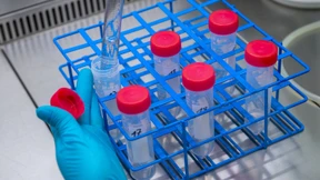 Corona im Abwasser früh nachweisbar