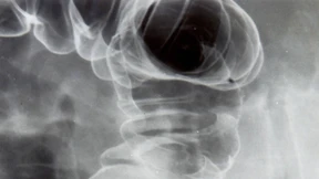 Alle lieben den Darm