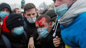 Scharfe Kritik an Polizeigewalt bei Protesten