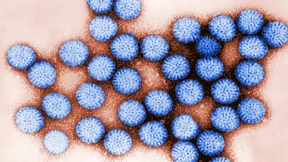 Infektionen immer häufiger Todesursache