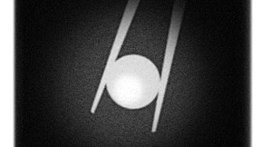 Sollte man die Eizellenspende zulassen?