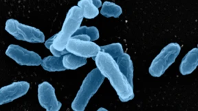 Resistenzen im Boden