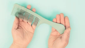 Was gegen kreisrunden Haarausfall hilft