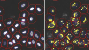 Mit der Licht-Pumpe gegen die Demenz
