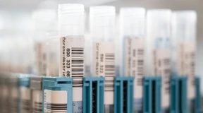 Inzidenz steigt leicht auf 1703,3