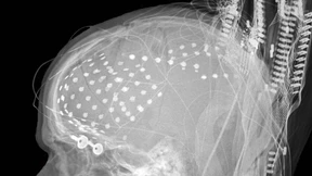 Affen steuern Rollstuhl allein mit Gedankenkraft