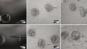 Patente auf menschliche Stammzellen verboten