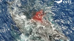 „Und plötzlich war da eine Menge Blut“