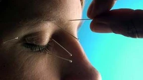 Warum die Migräne so oft missgedeutet wird