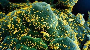 „Ich fühle mich zu jung zum Sterben“