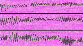 Doktor-KI auf Herz und Nieren geprüft